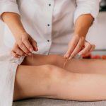 Acupuntura sendo aplicada em dor crônica no joelho